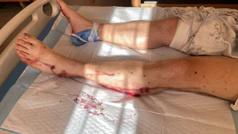 На Донеччині окупанти вдарили по пожежно-рятувальній частині: четверо рятувальни