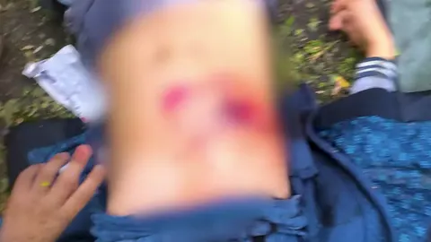 Обстріл Краматорська: поліція показала, як парамедики рятували пораненого хлопця